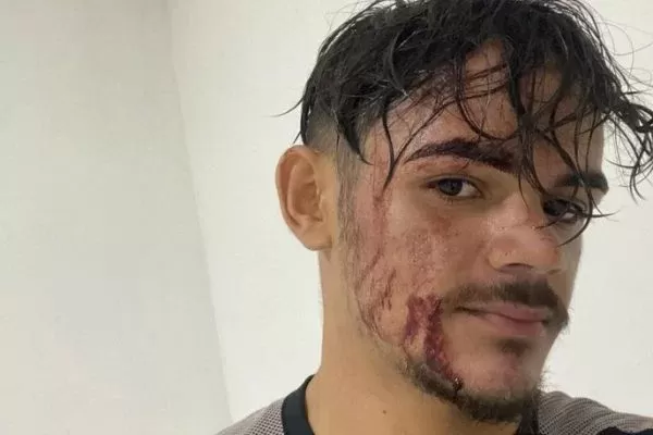 Motoboy denuncia agressão por atraso em entrega na Paraíba