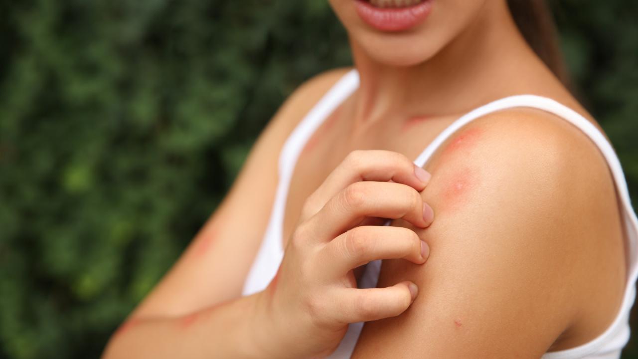 Brasil passa de 1,8 milhão de casos de dengue em 78 dias e bate recorde histórico
